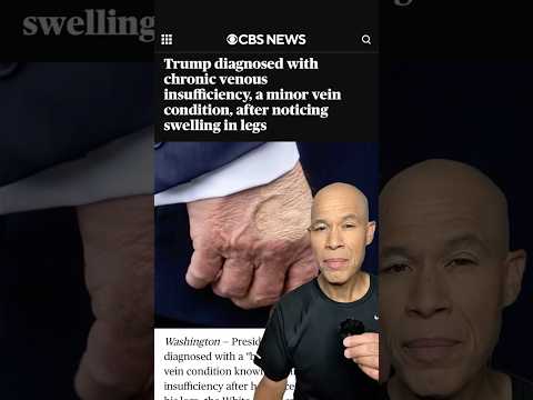 Trump diagnosed with chronic vein condition #shorts