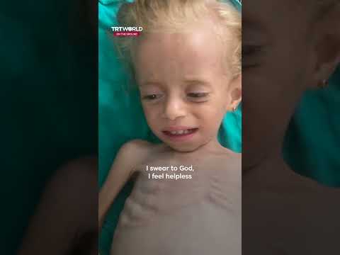 Trapped in hunger: Gaza’s child starvation crisis under Israeli blockade