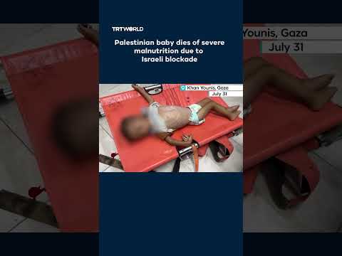 Palestinian baby dies of severe malnutrition due to Israeli blockade