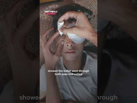 Palestinian teen waiting for aid loses eyesight after being shot by Israeli forces