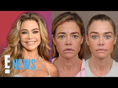 Denise Richards Reveals “Shocking” Facelift Before & After | E! News