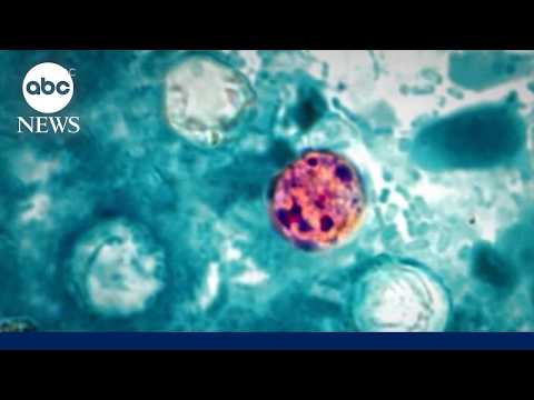Cyclosporiasis cases surge after RFK Jr. said outbreak was contained