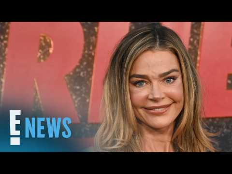 Denise Richards Details All the Plastic Surgery Procedures on Her Face | E! News