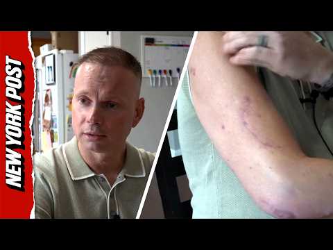 Injured Soldier Says Comrades Had to Google the Nearest Hospital During Iran Attack